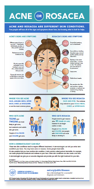 acne-or-rosacea-infographic-thumbnail